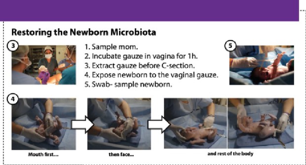 restoring c-section baby microbiota