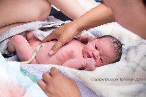 delayed cord clamping - image